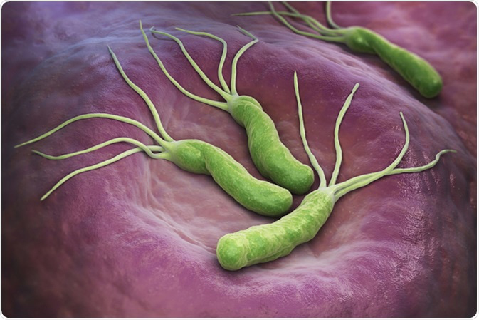 h-pylori-treatment-gastro-hospital-universal-hospitals